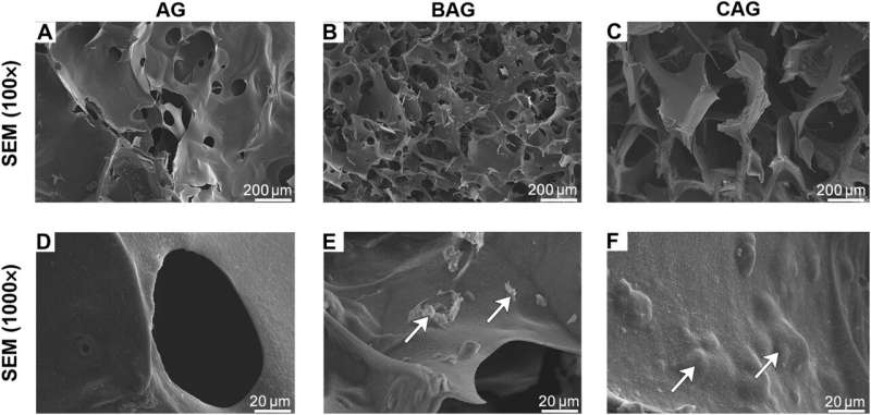 A biopolymer hydrogel with amino-functionalized bioactive glass for accelerated bone regeneration 