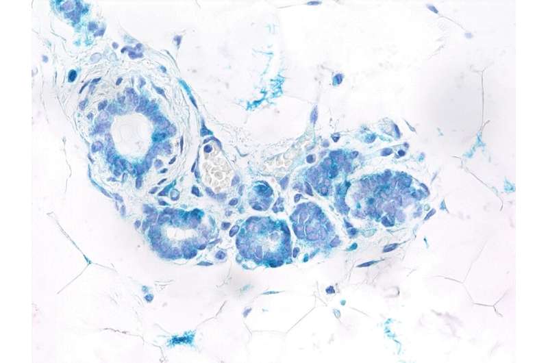由乳腺癌引发蛋白引起的衰老和干细胞之间的联系