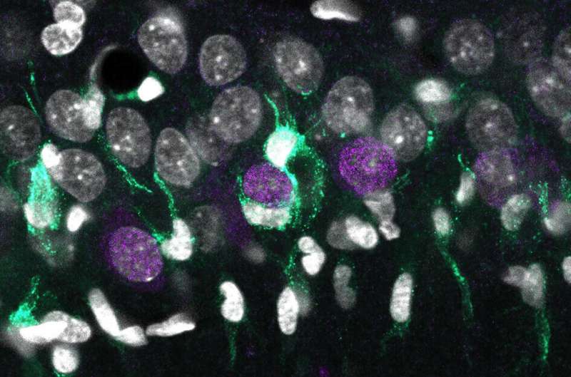 基因组单细胞地图解释在癫痫神经元死亡