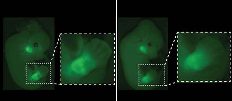 A missing genetic switch at the origin of embryonic malformations