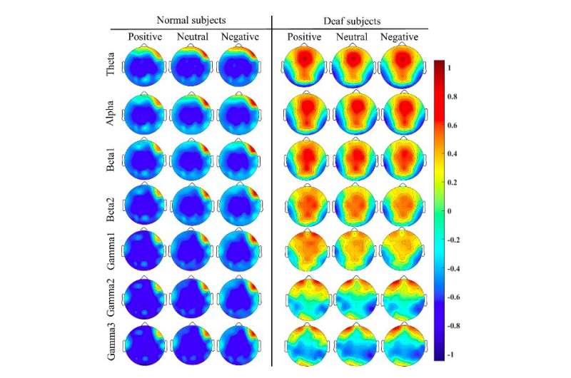 A new model to recognize emotions in deaf individuals by analyzing EEG signals 