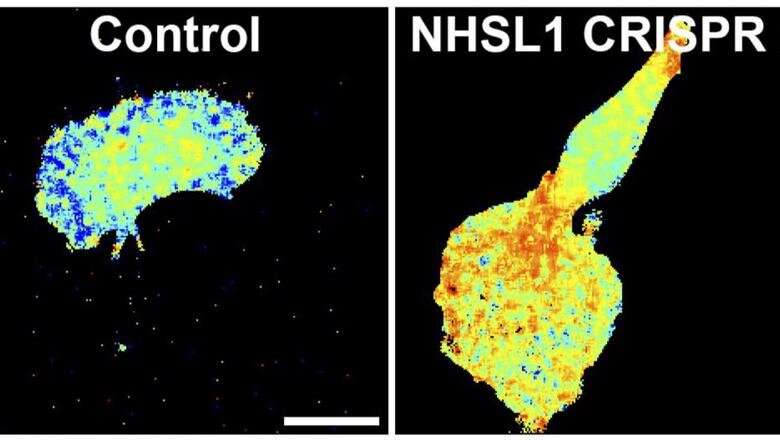 Advanced microscopy study reveals molecular details of tight control of cell migration