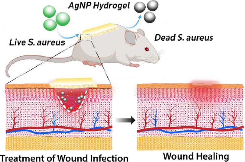 Advanced wound dressings to change how burns are treated in children