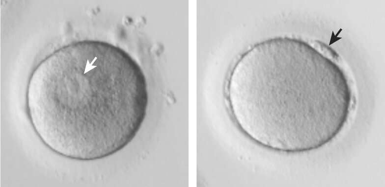 Ageing impairs critical final egg maturation stage