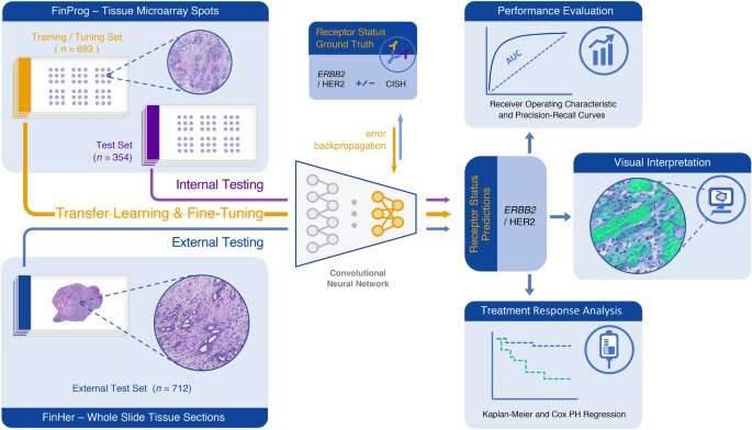 AI predicts efficacy of breast cancer treatment directly from tumor architecture