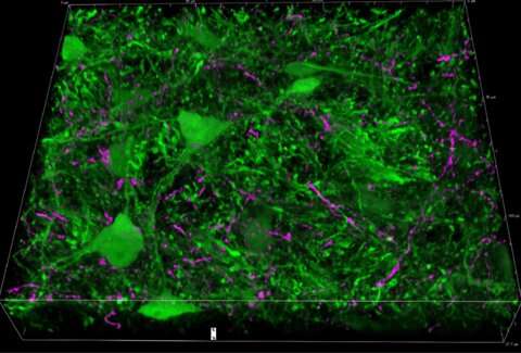 Se descubrió que la amígdala tiene un papel en un importante mecanismo de preatención en el cerebro