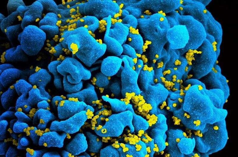 抗体输注可以预防一些艾滋病毒毒株，NIH研究发现