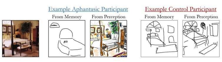 Aphantasia explained: some people can't form mental pictures