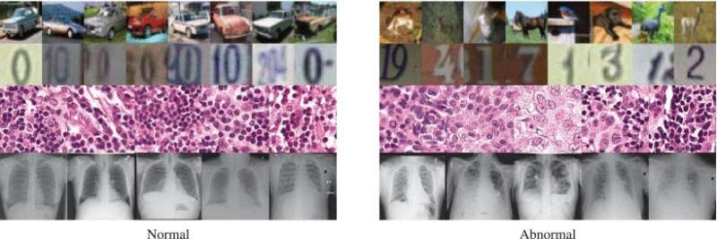 Artificial intelligence spots anomalies in medical images