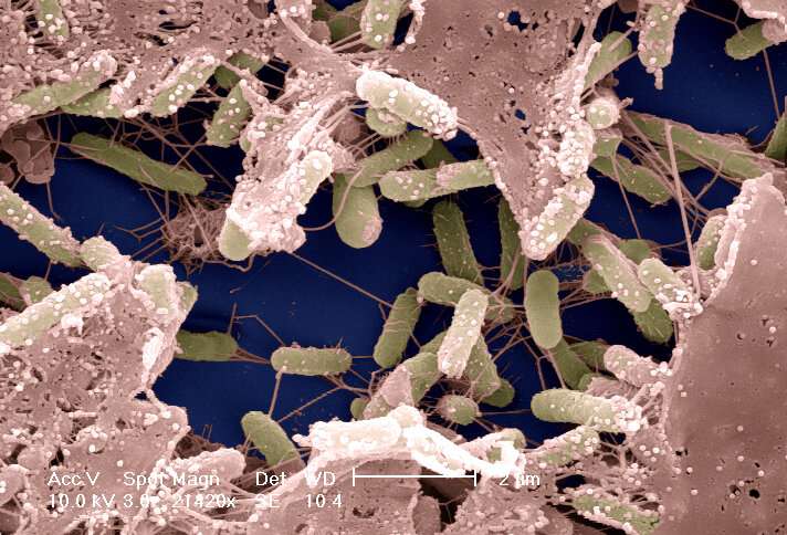 Beating biofilms: new study identifies essential genes for bacterial survival in the environment