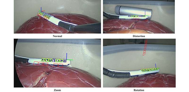 Best of both worlds: A hybrid method for tracking laparoscopic ultrasound transducers