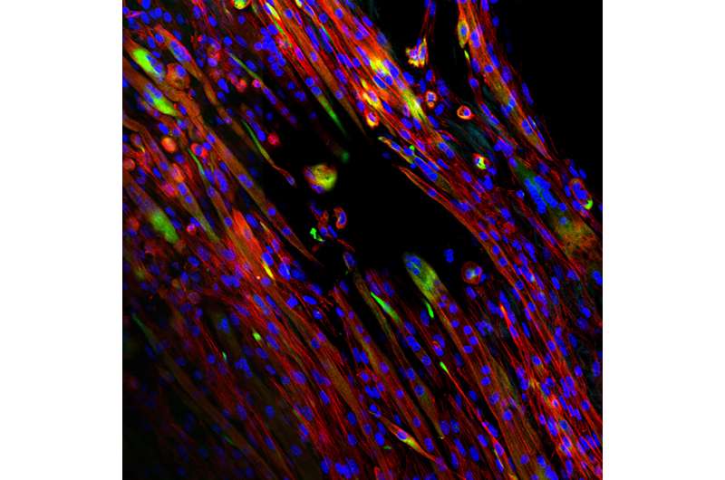 Bio-inspired scaffolds help promote muscle growth