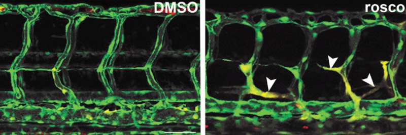 Blocking Distraction: How Growing Blood Vessels Do It All