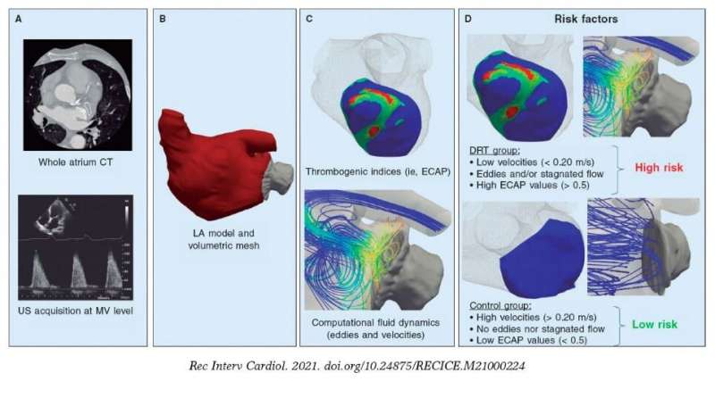 Blood flow simulations may improve the monitoring of atrial fibrillation