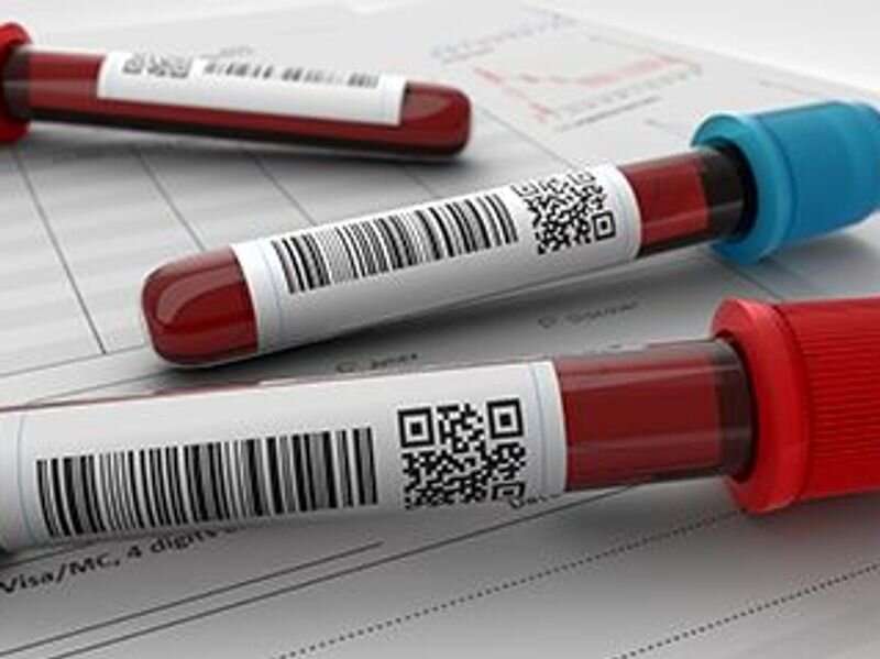 儿童的血铅水平测试在Covid-19期间降低