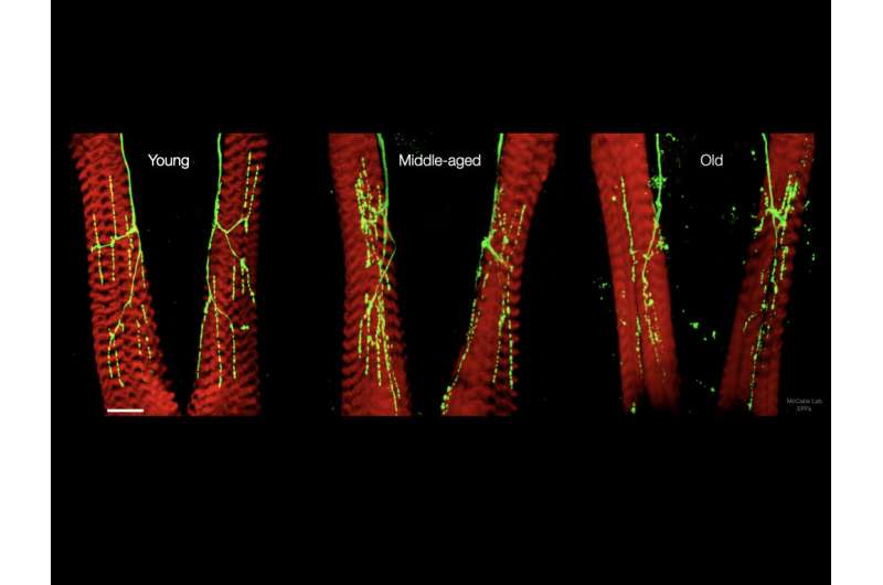 Brain 'noise' keeps nerve connections young