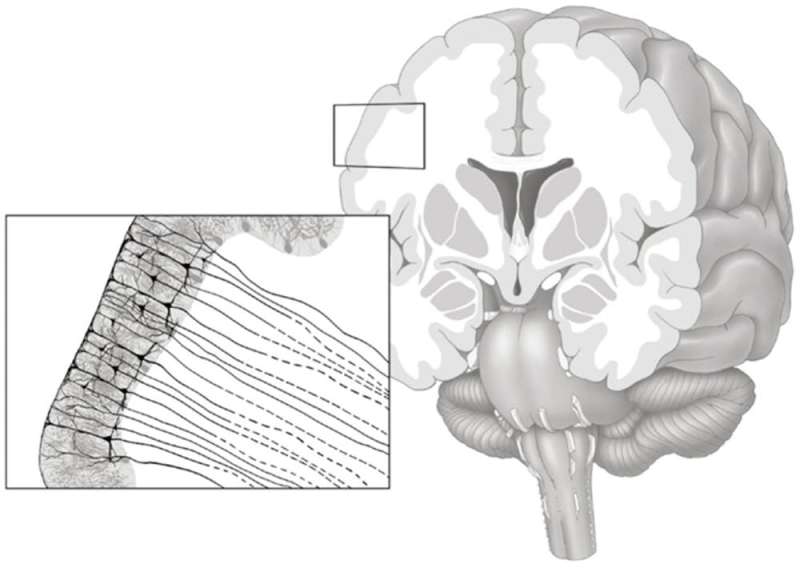 Brain wrinkles and folds matter – researchers are studying the mechanics of how they form