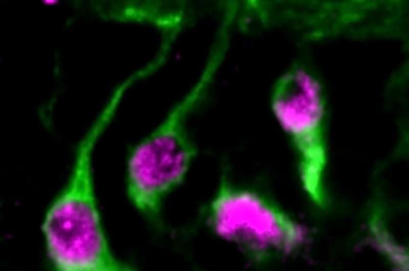 Brain enzyme found to activate dormant neural stem cells, providing insight into neurodevelopmental disorders