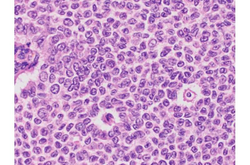 Cancer registry improves understanding of rare ovarian tumor