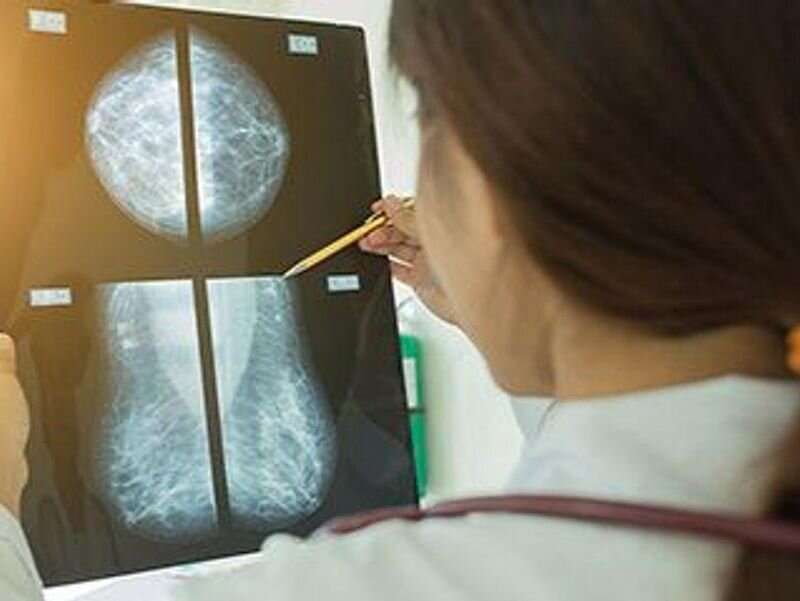 Cancer screenings disrupted during pandemic at federally qualified health centers