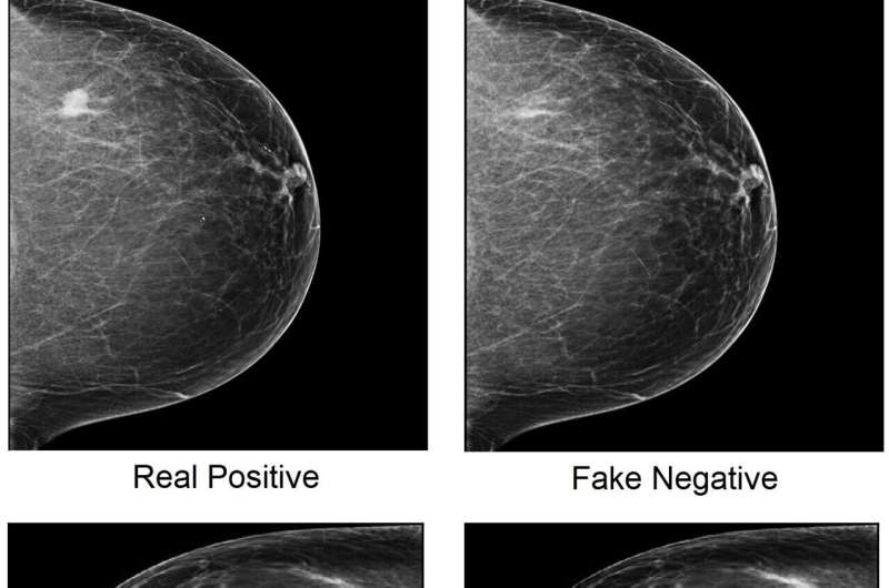 Cancer-spotting AI and human experts can be fooled by image-tampering attacks