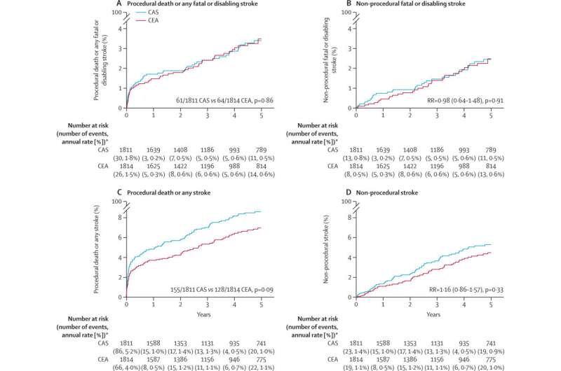 Carotid artery surgery and stenting have similar long-term effects on stroke