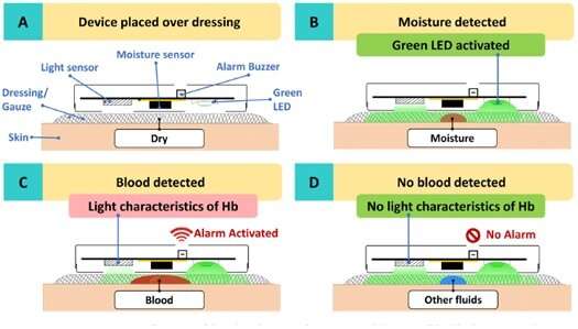 CGH and SUTD co-create and receive US patent for warning sensor in early detection of wound bleeding