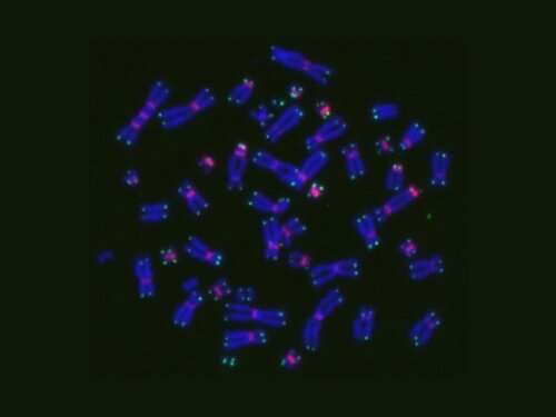 Chromosome aberrations may predict risk of severe chemoradiotherapy side effects