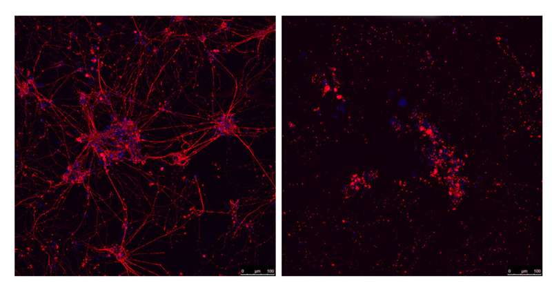 CNIO researchers discover the cause of neuronal death in a large proportion of familial ALS patients