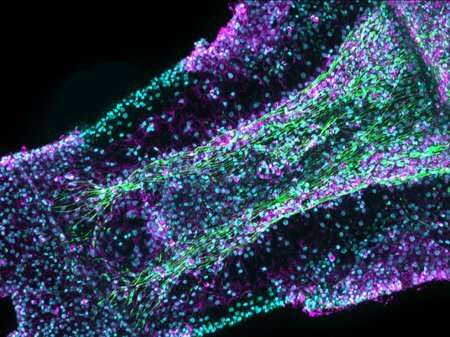 Coaxing jellyfish, flies and mice to regenerate body parts