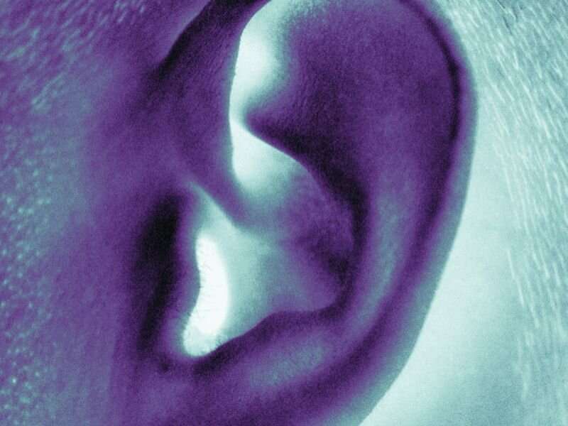 Cochlear implants aid speech recognition in most adults