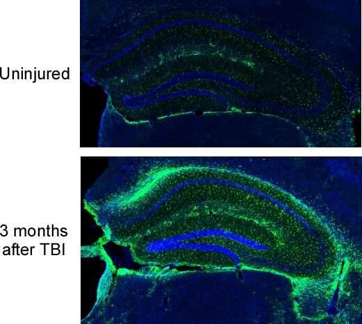 Complement inhibition reverses mental losses in preclinical traumatic brain injury models