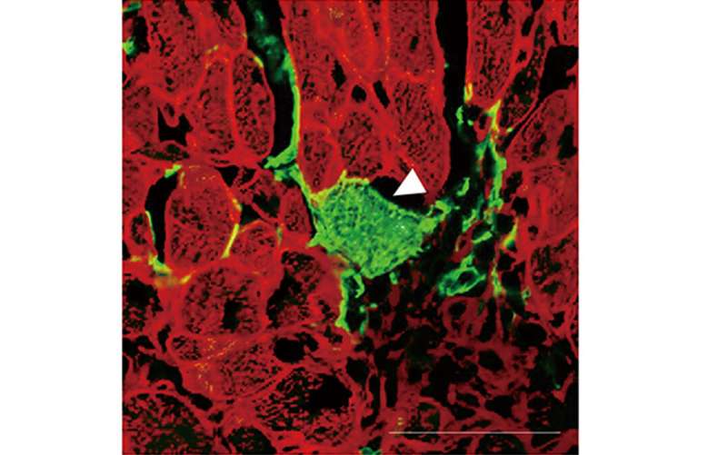 Converting scar tissue to heart muscle after a heart attack