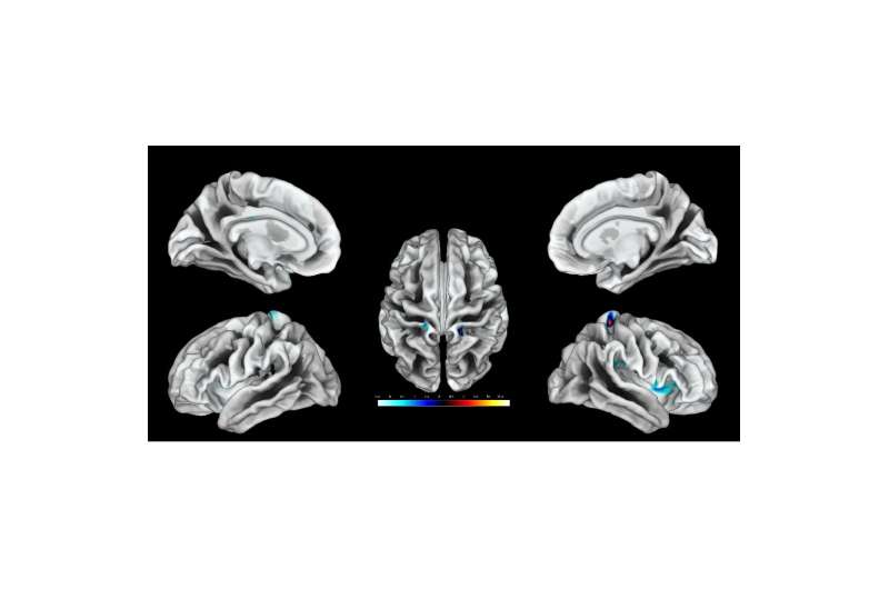 Cortical surface mapping of stimulation of the clitoral region—a new study has identified the brain region linked to genital tou