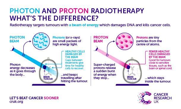 Could proton beam therapy improve throat cancer treatment?