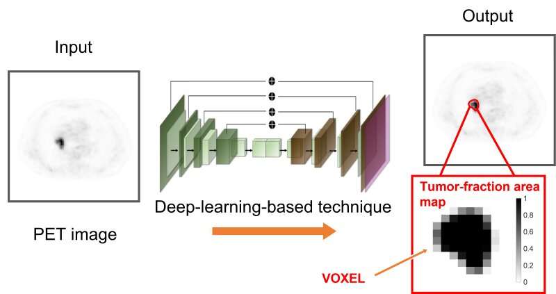 Deep learning improves interpretation of tumors