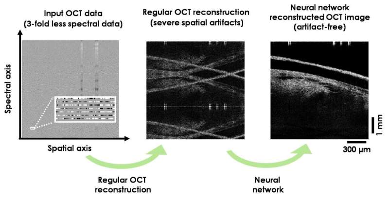 Deep learning improves image reconstruction in optical coherence tomography using less data