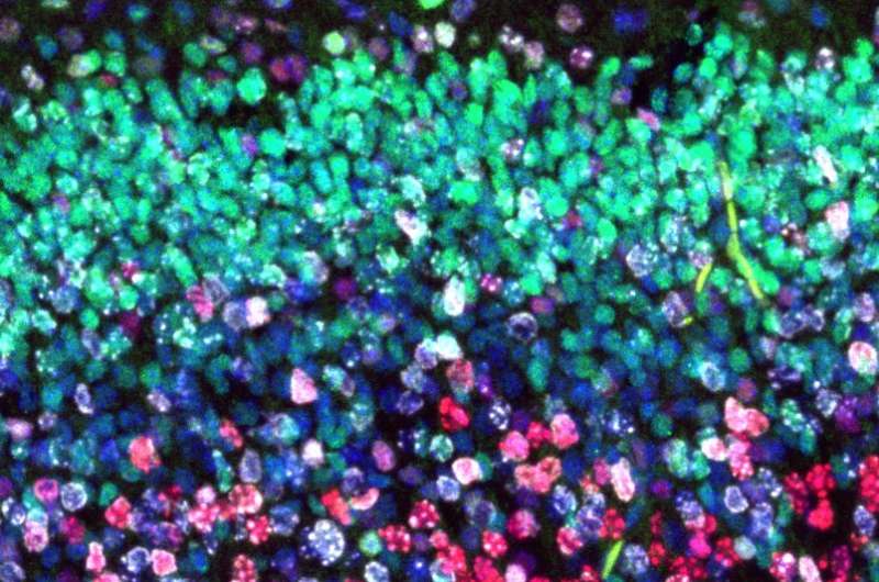Defective gene slows down brain cells
