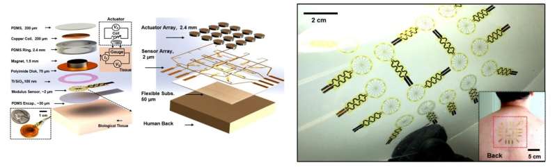 Detecting skin disorders based on tissue stiffness with a soft sensing device