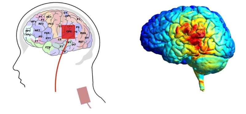 Direct current stimulation of the brain over Wernicke's area can help people learn new words