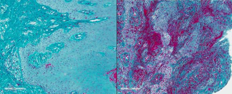 خلع سلاح یک پروتئین لخته کننده خون از بیماری لثه در موش جلوگیری می کند