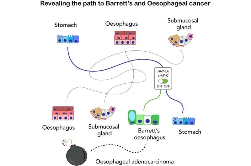 Discovery of origin of oesophageal cancer cells highlights importance of screening for pre-cancerous Barrett’s oesophagus