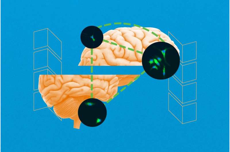 发现未知brain-repair过程可能导致新的癫痫治疗