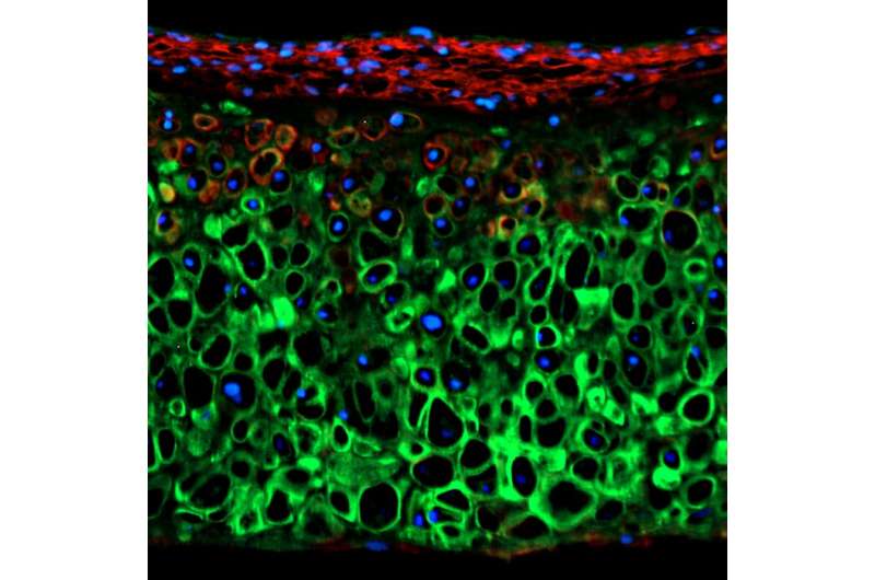 Discovery that TRPV4 gene regulates cartilage growth might yield future therapies for joint repair