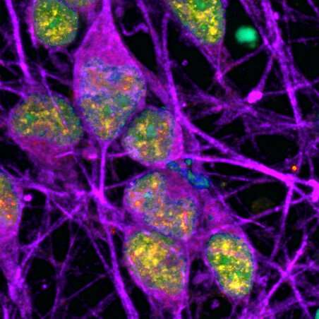 DNA damage 'hot spots' discovered within neurons
