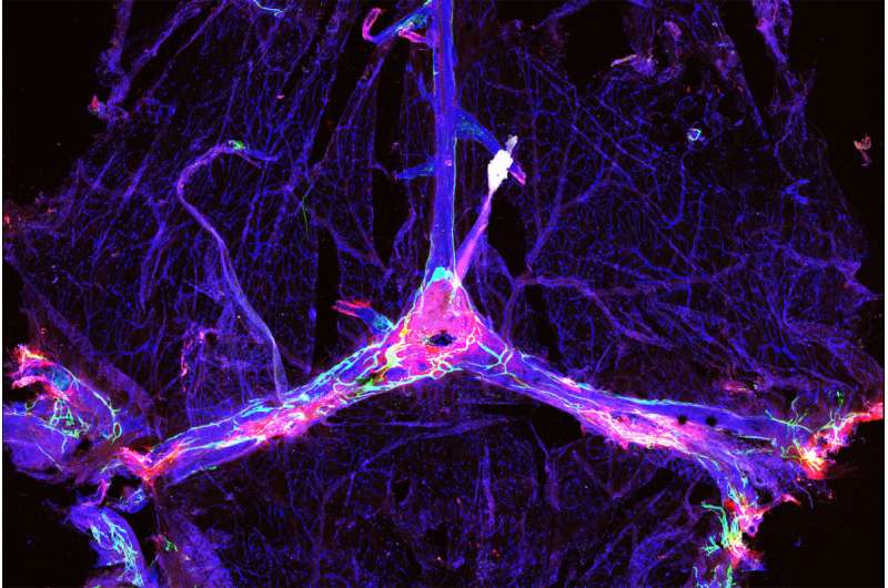 Draining brain's debris enhances Alzheimer's therapies in mice