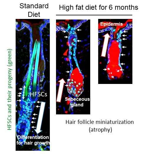 Eating less fat may save your hair