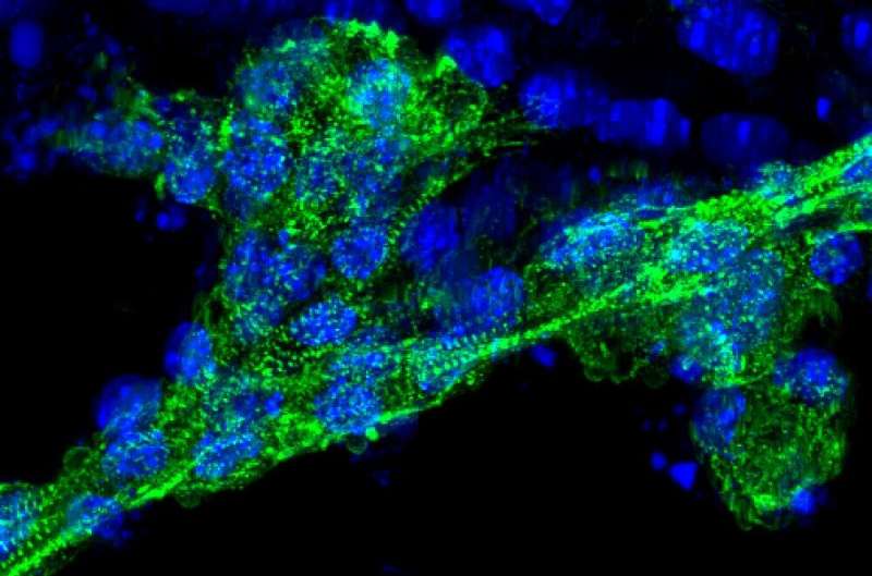 Engineered cells successfully treat cardiovascular and pulmonary disease