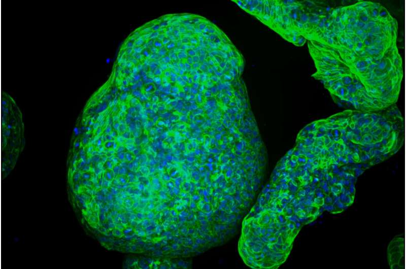 Engineers grow pancreatic “organoids” that mimic the real thing