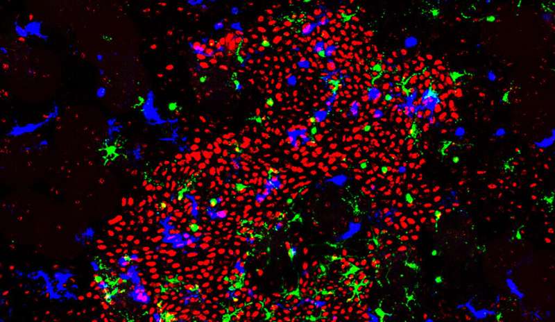 Exposing a cellular double-agent that helps skin cancer take hold
